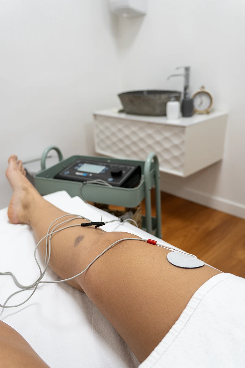 Electrolisis EPTE equipo profesional en Fisio Innova